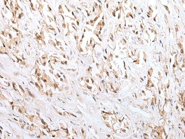 Polyclonal Rabbit anti-Human ZNF34 Antibody (IHC)