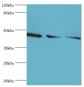 Polyclonal Rabbit anti-Human FLOT2 / Flotillin 2 Antibody (aa239-428, IHC, WB)