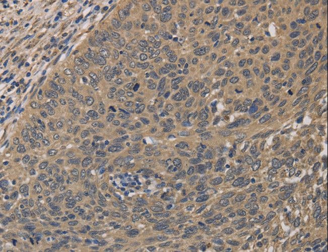 Polyclonal Rabbit anti-Human HSF1 Antibody (IHC)