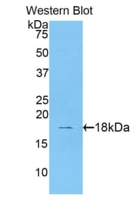 PDGF-BB Antibody (aa82-190)