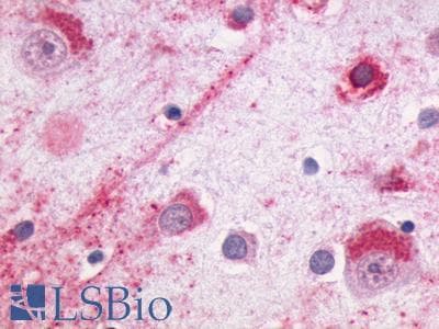 PathPlus™ Polyclonal Rabbit anti-Human NMUR2 Antibody (C-Terminus, IHC)