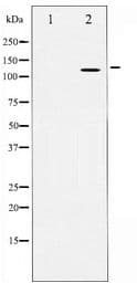 APP / Beta Amyloid Precursor Antibody