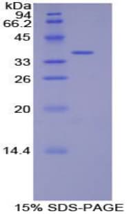 Rat DEFB4A / BD-2 Protein (Recombinant His-GST)