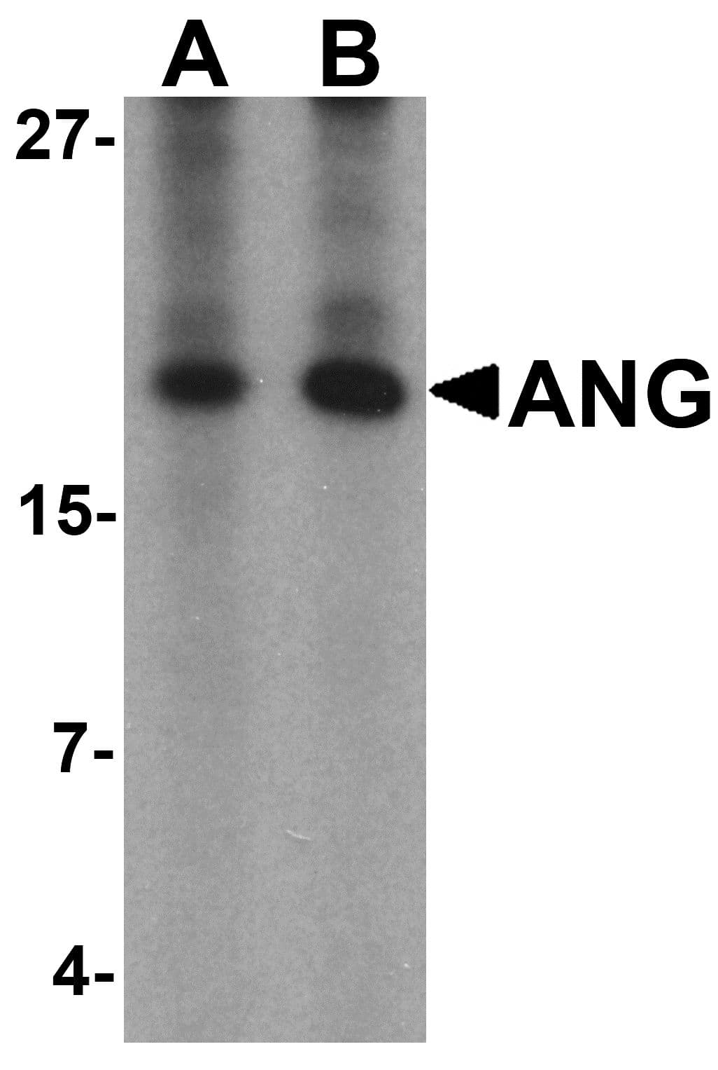 IHC-plus™ Angiogenin / ANG Antibody