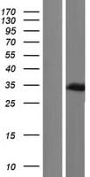 OTX2 Protein (Over-Expression Lysate Myc-DDK (Flag))