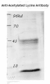 Polyclonal Rabbit Acetyl-Lysine Antibody (WB)