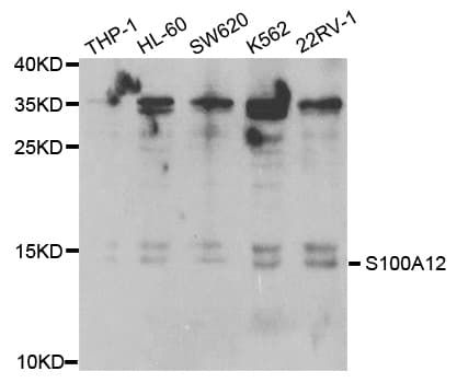 IHC-plus™ Polyclonal Rabbit anti-Human S100A12 Antibody (IHC, WB)