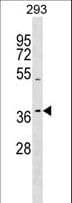 T2R13 / TAS2R13 Antibody (aa199-228)