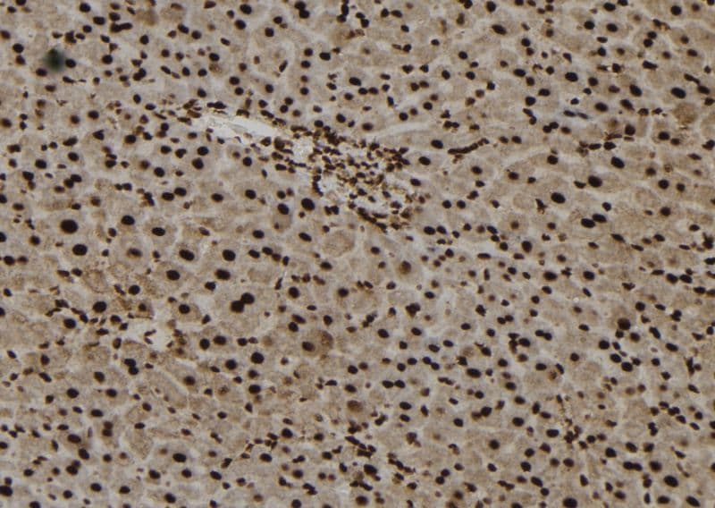 FOXO6 Antibody