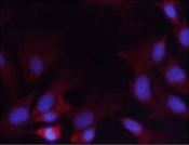 PTEN Antibody