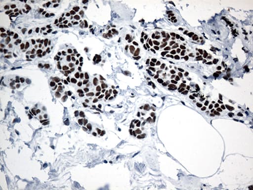 GTF3C4 Antibody (aa583-822, clone OTI3D4)