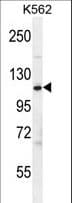 Polyclonal Rabbit anti-Human CFH / Complement Factor H Antibody (aa751-780, IHC, IF, WB)