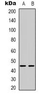 BTBD6 Antibody (Internal)