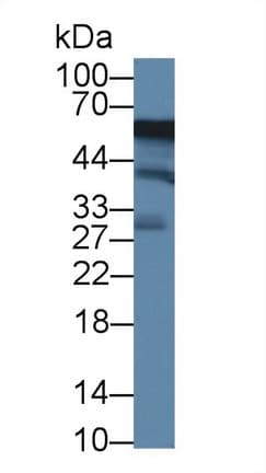 ACP6 Antibody