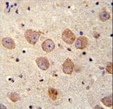 SKOR2 Antibody (aa870-898)