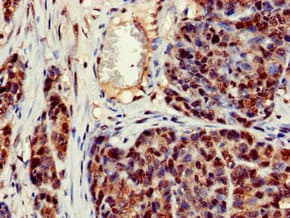 CRCP / CGRP Receptor Component Antibody