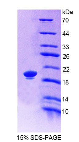 Rat LRP11 Protein (Recombinant His-T7, N-terminus)