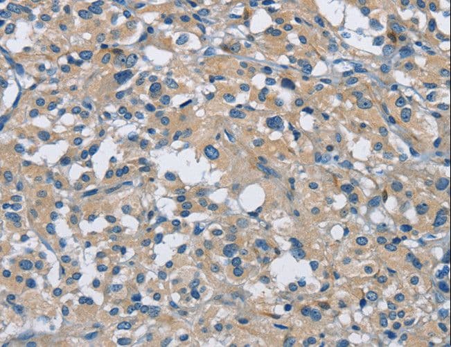 CAB39L Antibody