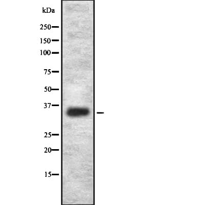 Polyclonal Rabbit anti-Human OR2L2 Antibody (WB)