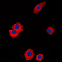 Polyclonal Rabbit anti-Human NBL1 / DAN Antibody (C-Terminus, IF, WB)