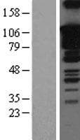 SOX5 Protein (Over-Expression Lysate Myc-DDK (Flag))