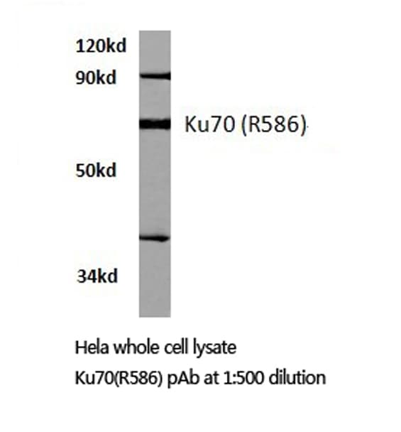 XRCC6 / Ku70 Antibody (Arg586)