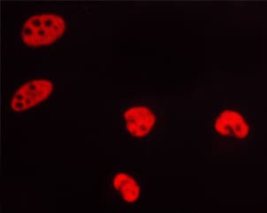 PR / Progesterone Receptor Antibody (phospho-Ser400)