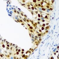 Polyclonal Rabbit anti-Human CDKN1C / p57 Kip2 Antibody (IHC, IF, WB)