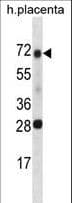 SPINT1 / HAI-1 Antibody (aa178-207)