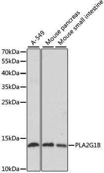 Polyclonal Rabbit anti-Human PLA2G1B Antibody (IHC, WB)