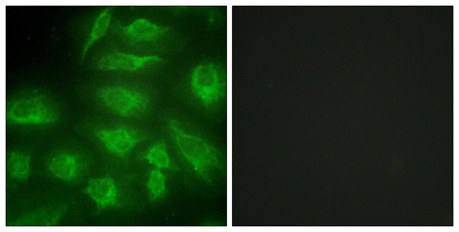 DGK-IOTA / DGKI Antibody