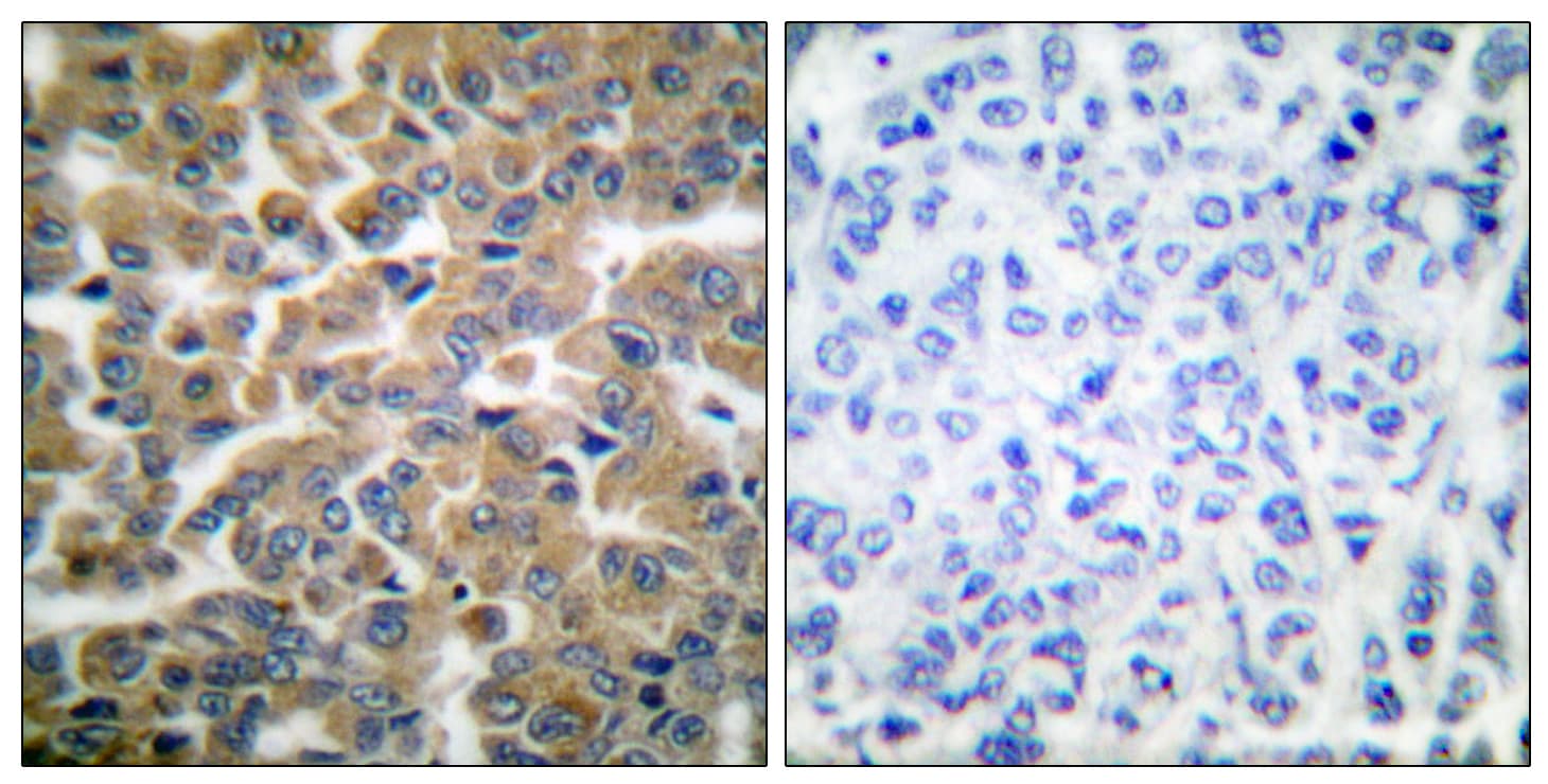 Polyclonal Rabbit anti-Human NR3C1/Glucocorticoid Receptor Antibody (aa181-230, IHC, IF, WB)