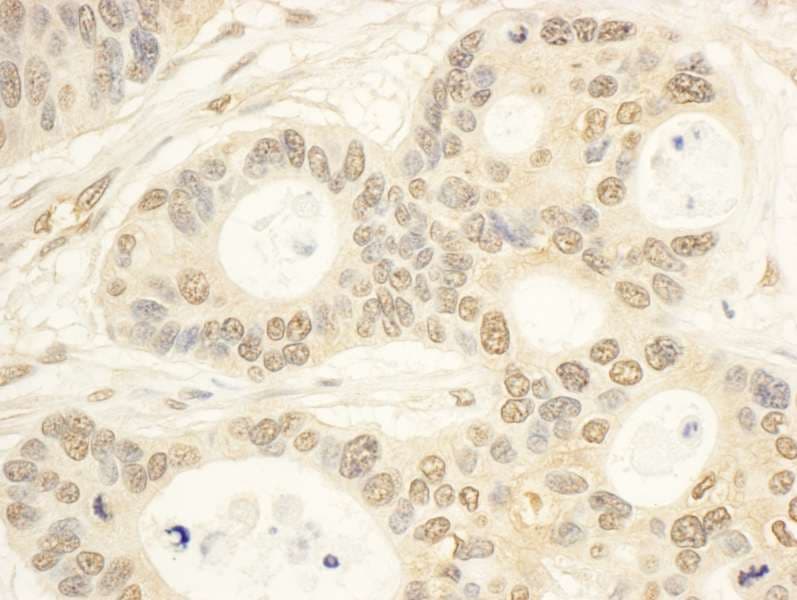 CIAPIN1 / Anamorsin Antibody (aa262-312)