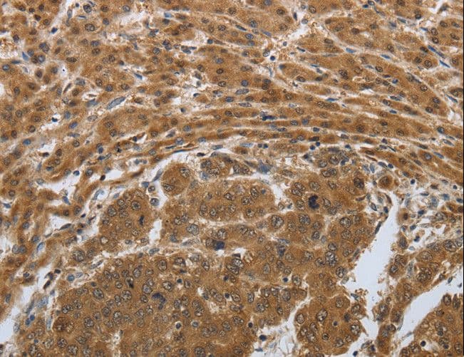 PSMD6 Antibody