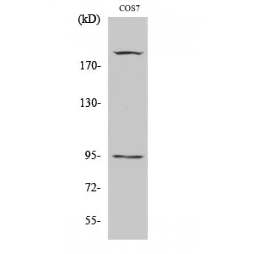 IGF1R / IGF1 Receptor Antibody (1100-1180 aa)