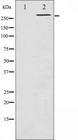 Polyclonal Rabbit anti-Human FLNA / Filamin A Antibody (phospho-Ser2152, IHC, IF, WB)
