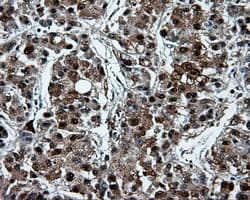 PSMC3 Antibody (clone OTI6E10)