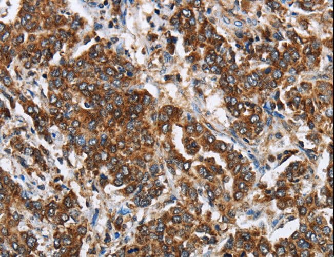 GGCX Antibody