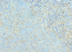ACTR2 / ARP2 Antibody (aa1-160)