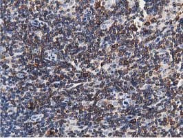 ERIC-1 / TACC3 Antibody (clone OTI3B1)