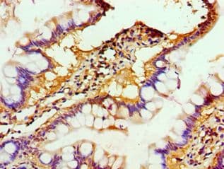 ABH2 / ALKBH2 Antibody (aa1-261)