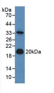 ADM / Adrenomedullin Antibody (aa24-171)