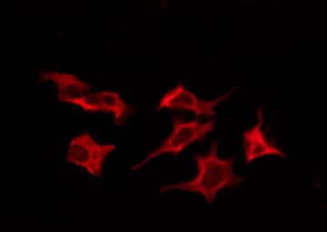 SLC52A1 / GPR172B / PAR2 Antibody