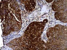 NME1 / NM23 Antibody (clone OTI7D6)