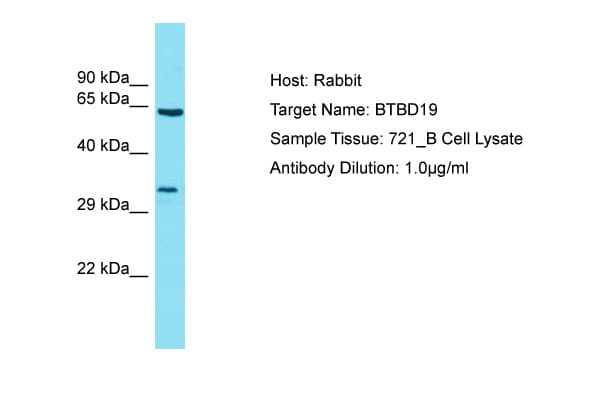 Polyclonal Rabbit anti-Human BTBD19 Antibody (aa208-257, WB)