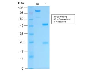 KRT16 / CK16 / Cytokeratin 16 Antibody (clone KRT16/1714, Azide-free, BSA-free)