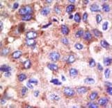 Polyclonal Rabbit anti-Human UBE2G1 Antibody (aa1-30, IHC, WB)