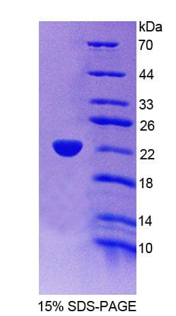Mouse ACOX3 Protein (Recombinant His-T7, N-terminus)
