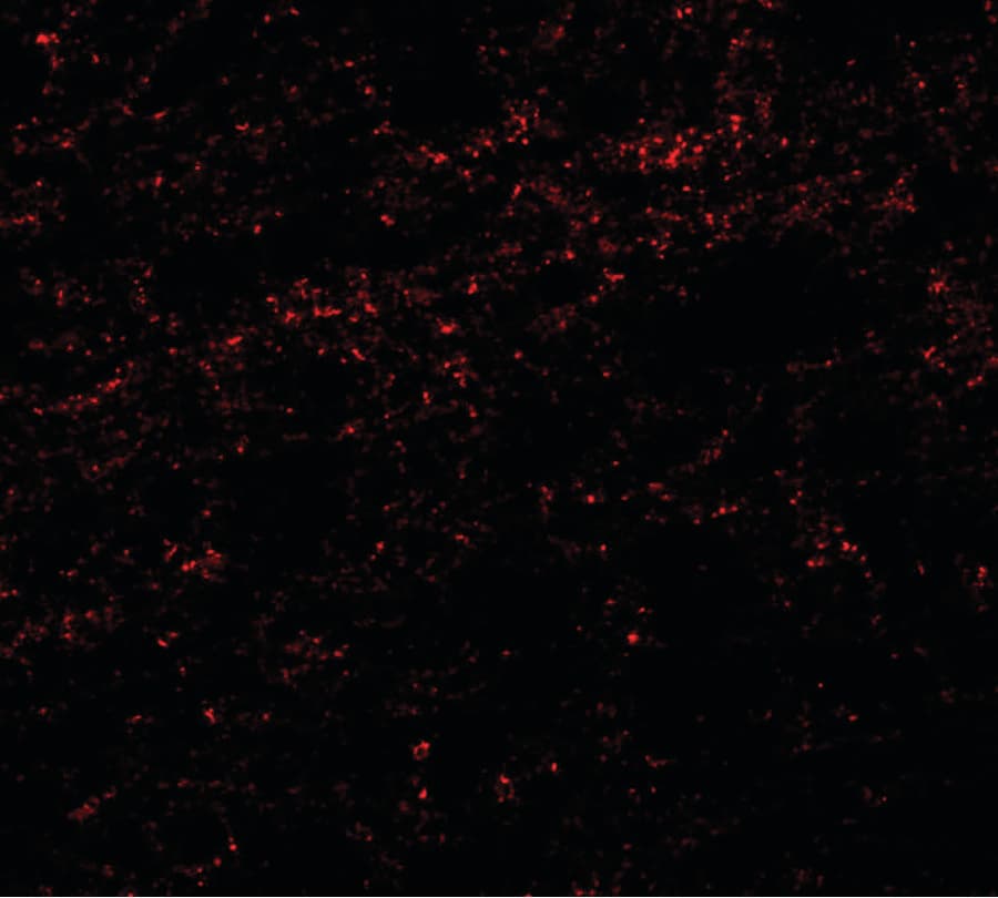 PHOX2A Antibody