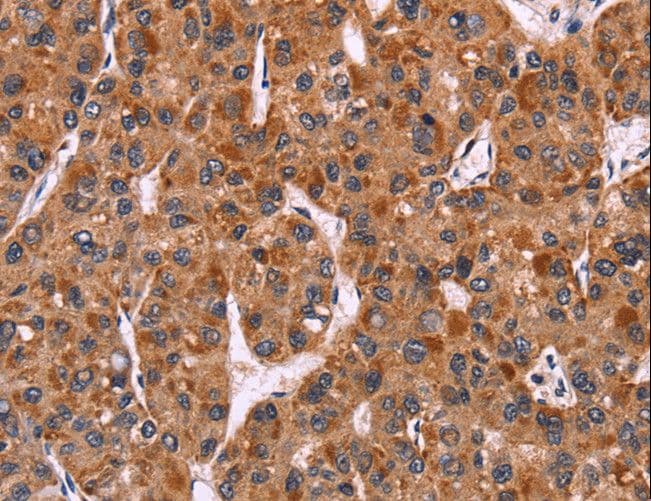 CARMA1 / CARD11 Antibody